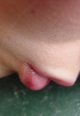 Selfshot Erotic Teen by I Shot Myself